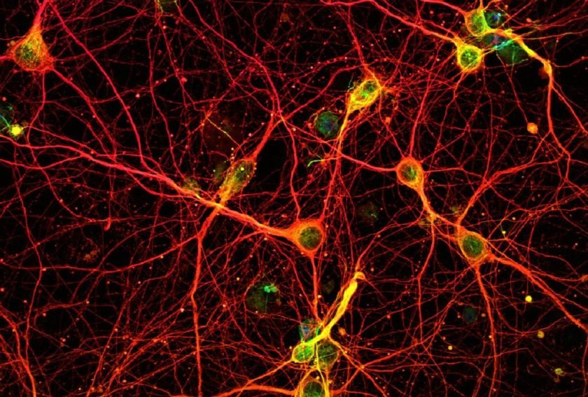 proteína FTL1 envejecimiento cerebral