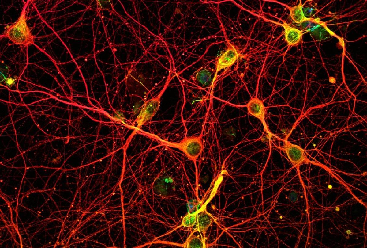 proteína FTL1 envejecimiento cerebral