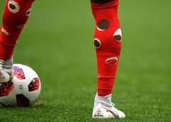 Descubre por qué los futbolistas cortan sus calcetas y la explicación médica detrás de esto